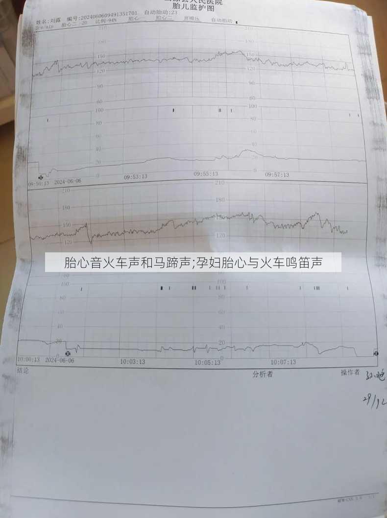 胎心音火车声和马蹄声;孕妇胎心与火车鸣笛声